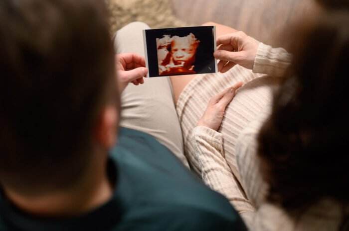 Kismama és párja meghitt babaváró fotózása Debrecenben, ahol együtt nézik születendő gyermekük ultrahangképét. Várandós fényképezés stúdióban, amely örök emlék marad a család számára.